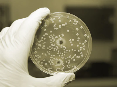Salmonella testing 57b47acdbc07a